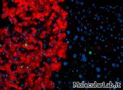Fibroblasti trasformati in iPS e poi cellule fegat