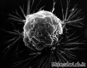 Cellula tumorale