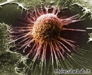 Cellula cancerosa