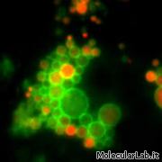 Lisosomi evidenziati con immunofluorescenza