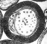 Cellule di Schwann: la guaina mielinica per assoni