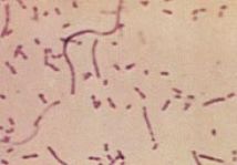 Haemonophilus influenzae