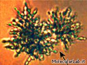 Lievito multicellulare