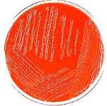 Piastra di Pasteurella multocida, Encefalite