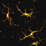 Dentriti in verde la proteina L1