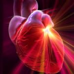 Attacco cardiaco