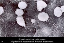 Formazion placca ateroscletorica:adesione monociti